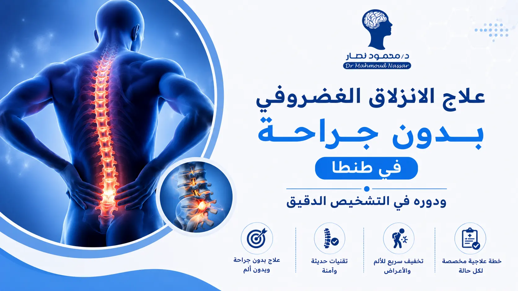 علاج الانزلاق الغضروفي في طنطا