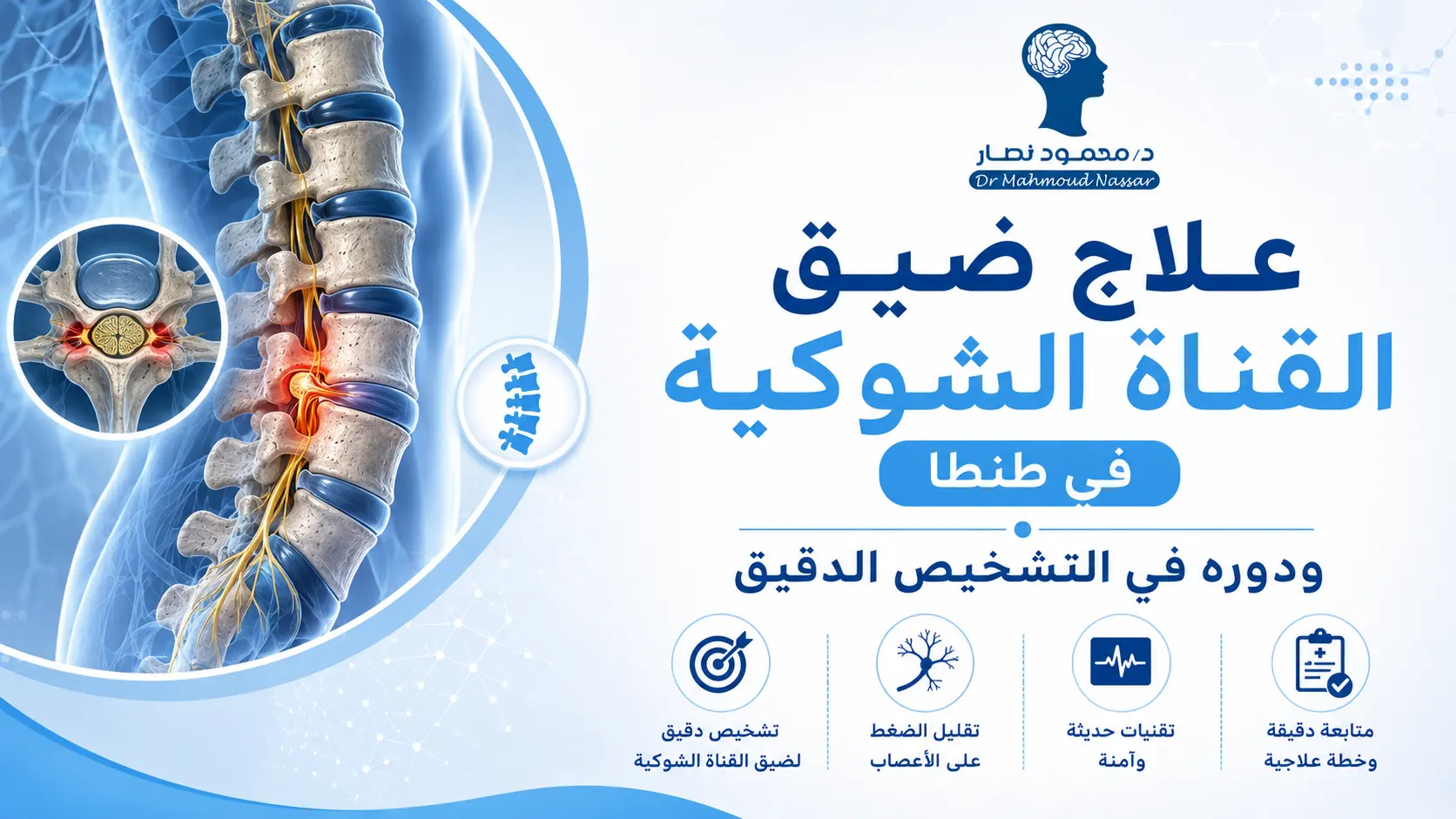 علاج ضيق القناة الشوكية في طنطا